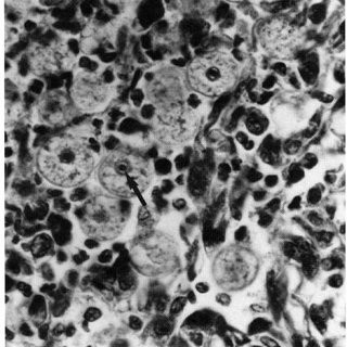 เปิด 5 สถิติน่ารู้ “อะมีบาในลำไส้หมา” โรคพยาธิที่เจอได้น้อย...แต่รุนแรงไม่น้อย (อัปเดท 2025)